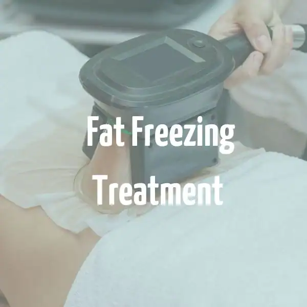 fat freezing treatment Nuneaton