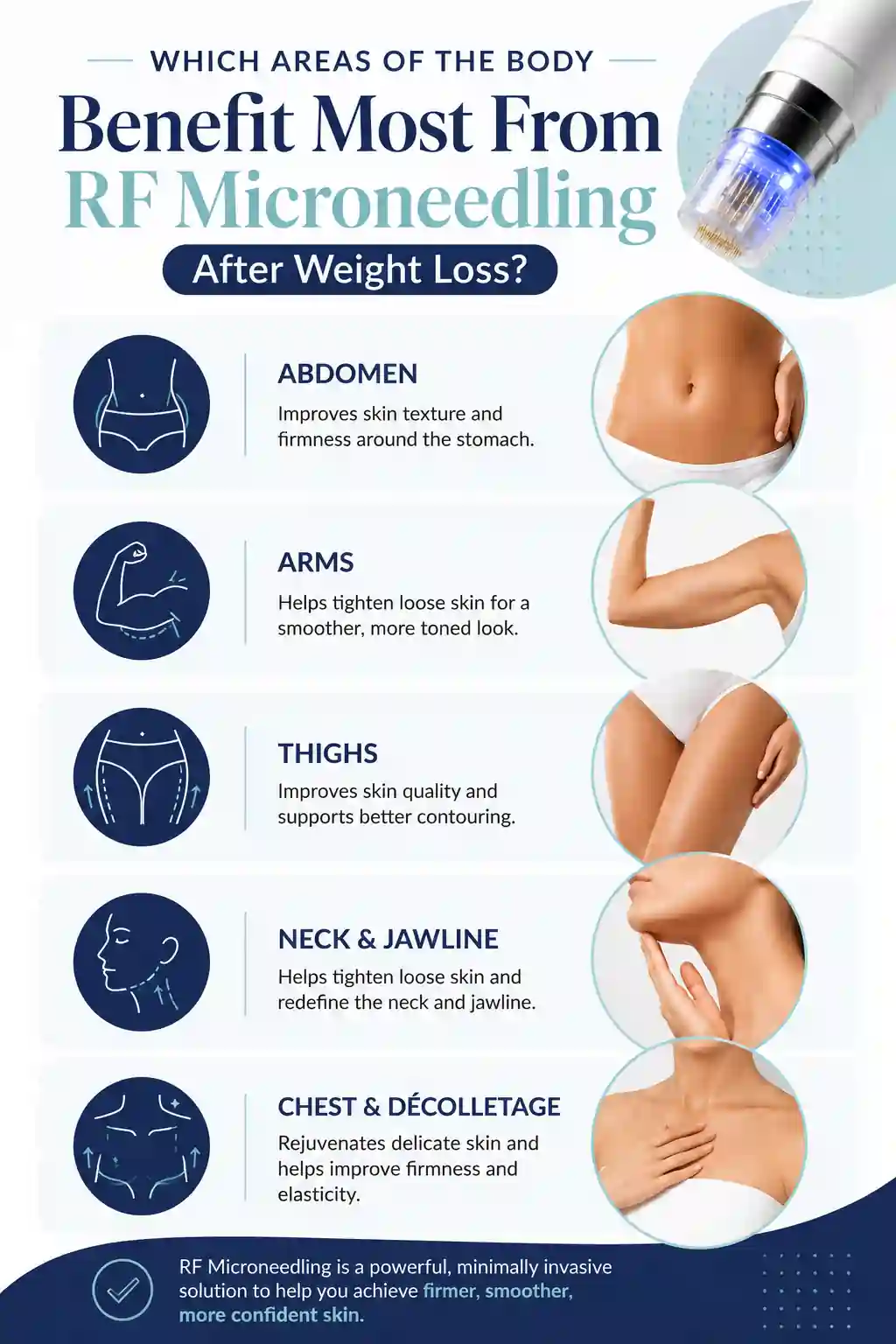 Which Areas of the Body Benefit Most From RF Microneedling After Weight Loss Nuneaton