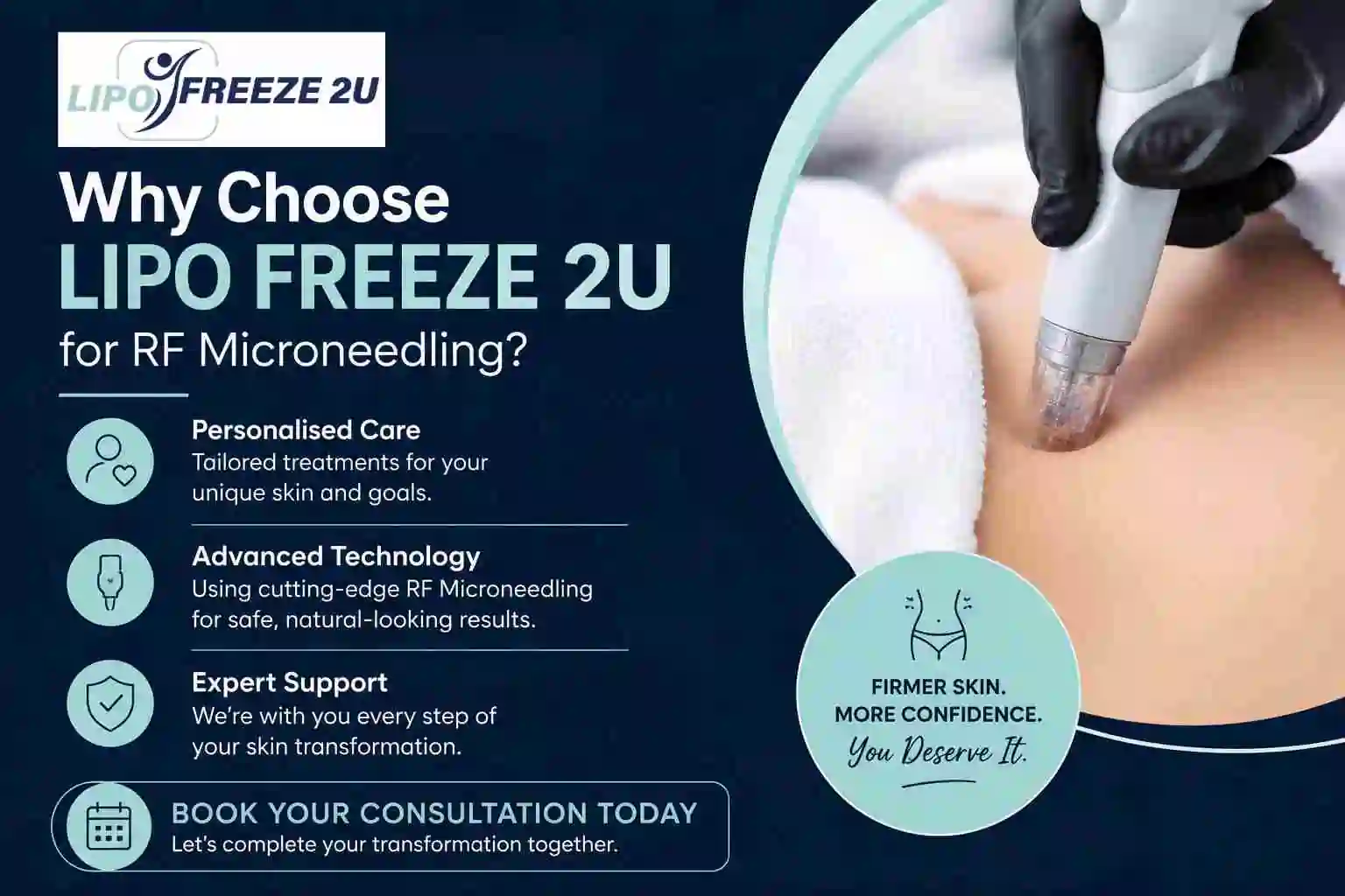 Why Choose LIPO FREEZE 2U for RF Microneedling Nuneaton?